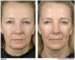 People Looking For A Doctor Who Can Perform A Neck Lift