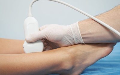 Understanding Peripheral Neuropathy And Treatment in Atlanta, GA: A Comprehensive Overview