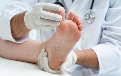 Experienced Foot Ankle Doctor in Marietta, GA: Specializing in Sports Injuries, Diabetic Foot Care, and More