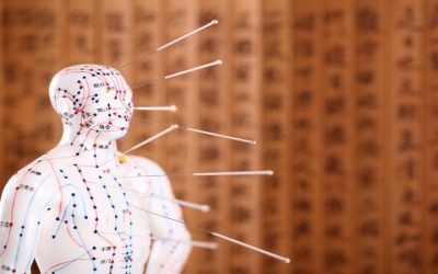 Three Benefits You Might Experience From A Acupuncture Treatment In Scottsdale AZ